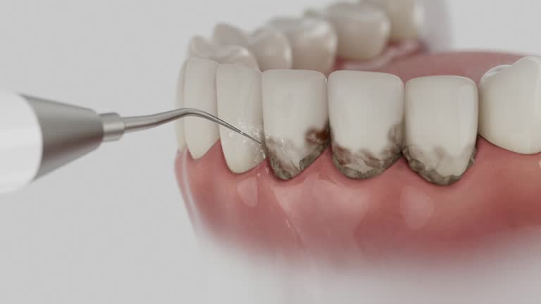 Trusted Dental Crowns And Bridges service in Mount Pleasant, IA - Dentist Open Now
